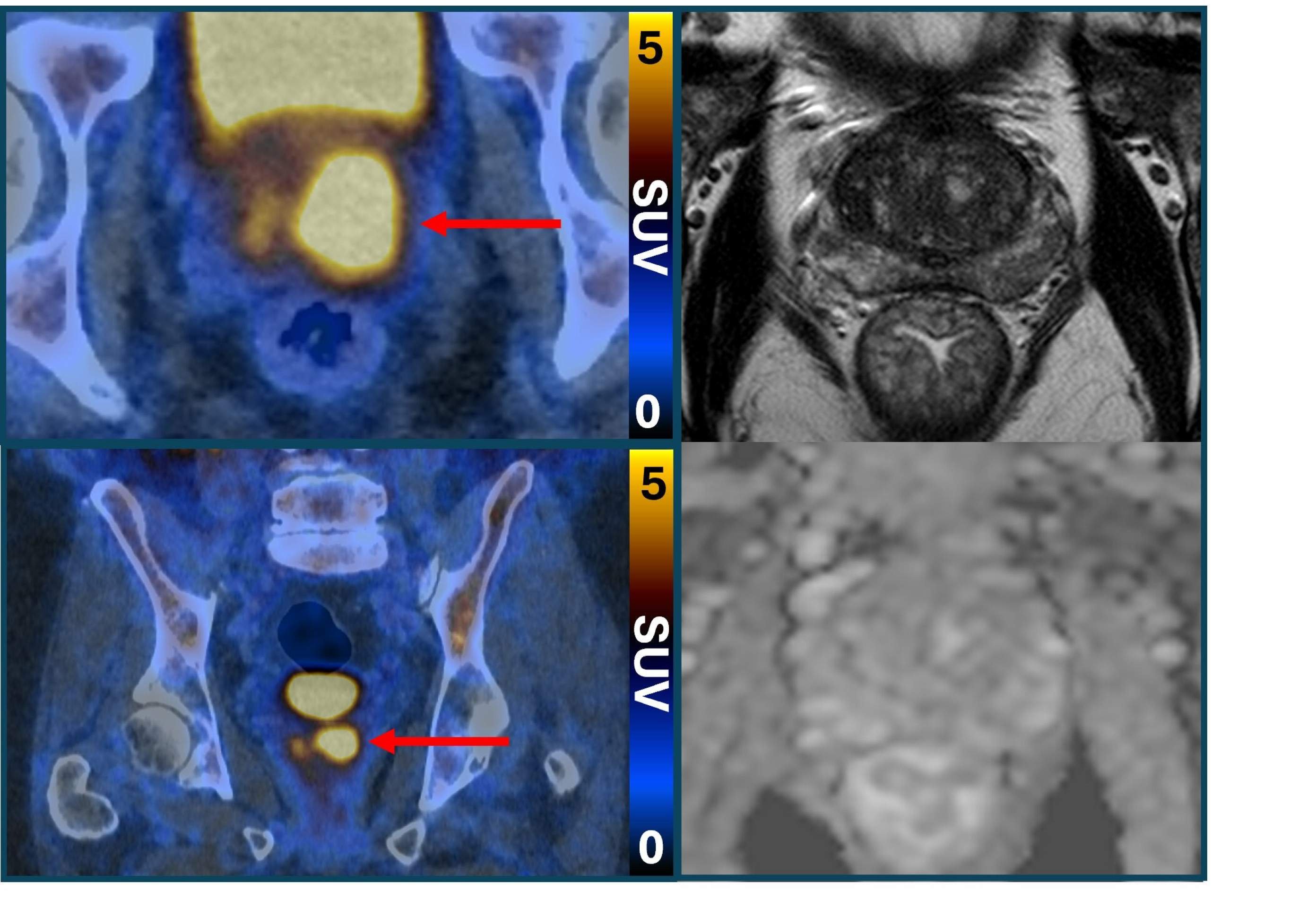 Exame não invasivo surge com esperança para diagnosticar câncer