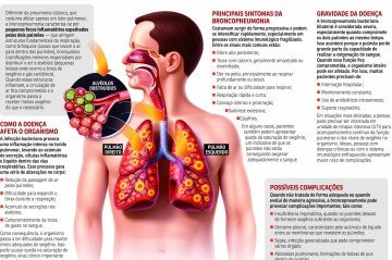 Broncopneumonia -  (crédito: Valdo Vigo)