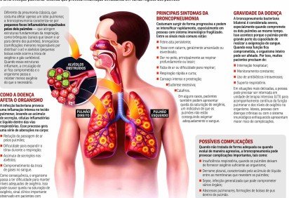 Broncopneumonia -  (crédito: Valdo Vigo) -Broncopneumonia -  (crédito: Valdo Vigo)