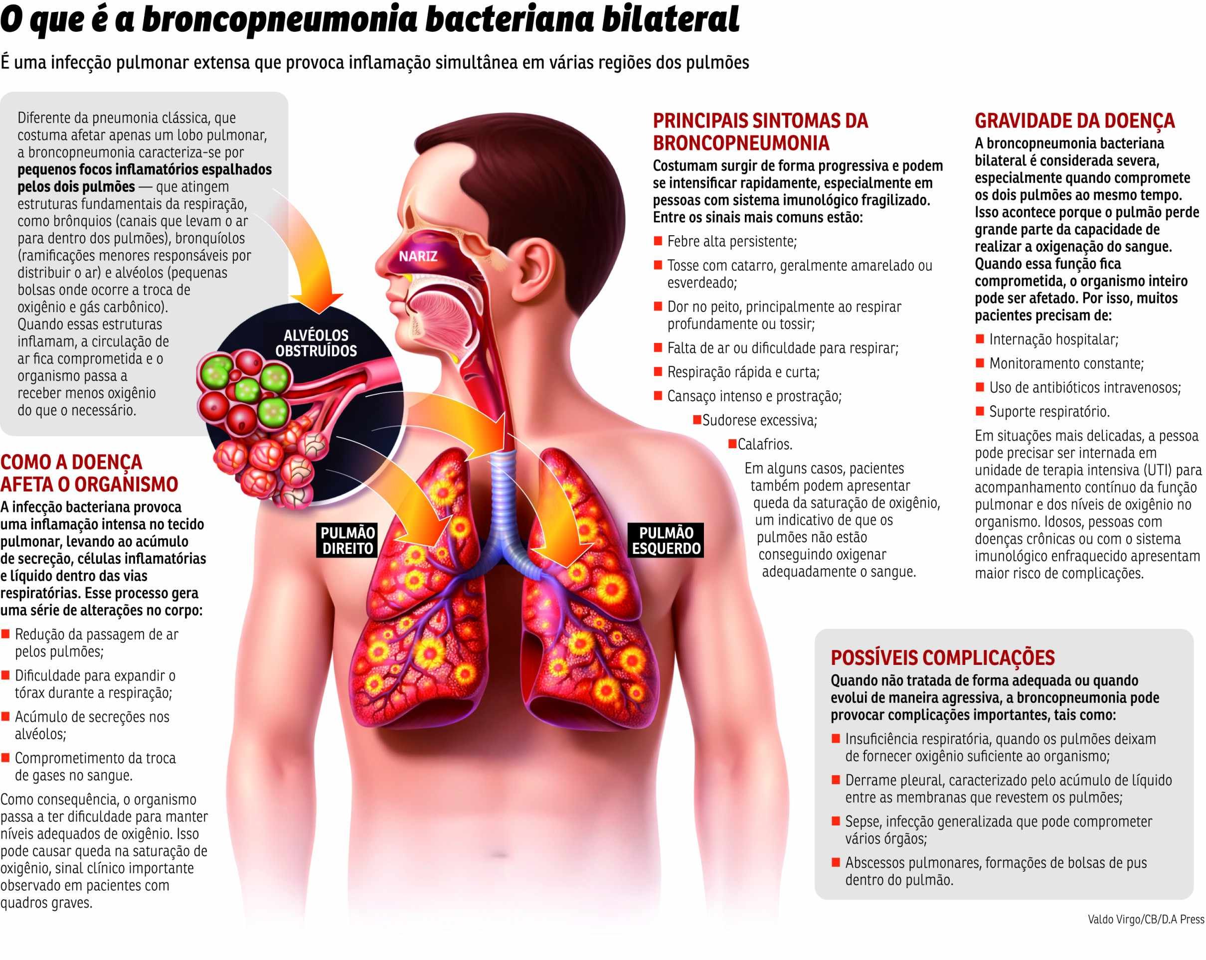 Broncopneumonia