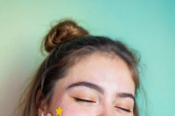 Os adesivos servem para auxiliar, mas não substituem as recomendações medicamentosas indicadas por dermatologistas - (crédito: Freepik) Os adesivos servem para auxiliar, mas não substituem as recomendações medicamentosas indicadas por dermatologistas - (crédito: Freepik)