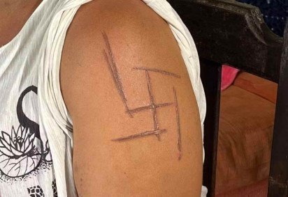 Mulher teve suástica marcada por faca -  (crédito: Reprodução/TV Morena)