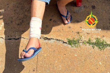 A vítima foi encaminhada ao Hospital Regional do Paranoá para tratar ferimento na perna -  (crédito: Divulgação/PMDF)