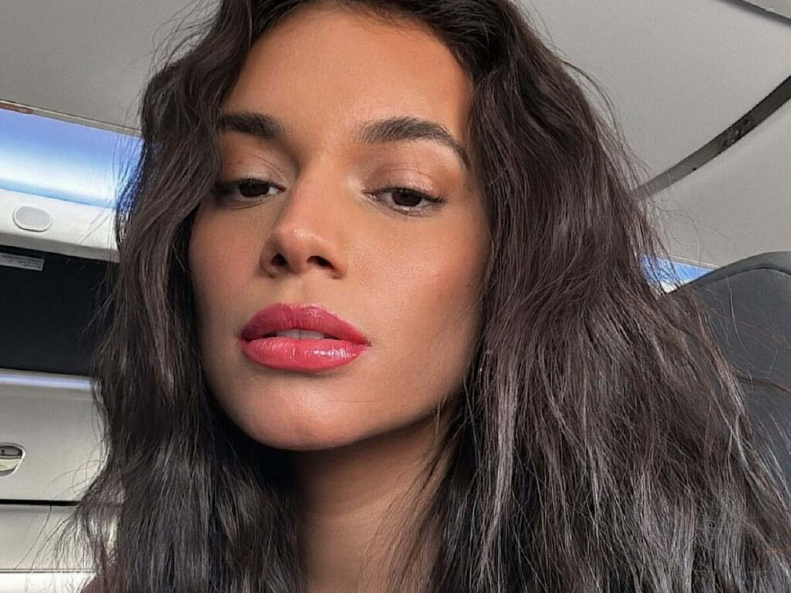 Alane Dias é atropelada no Rio e desabafa: "Muito rápido" - (crédito: Reprodução/ Instagram @alane) Alane Dias é atropelada no Rio e desabafa: "Muito rápido" - (crédito: Reprodução/ Instagram @alane)