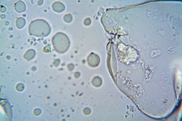 A molécula faz com que as células tumorais passem a produzir menos energia
 -  (crédito: Pexels Turek)