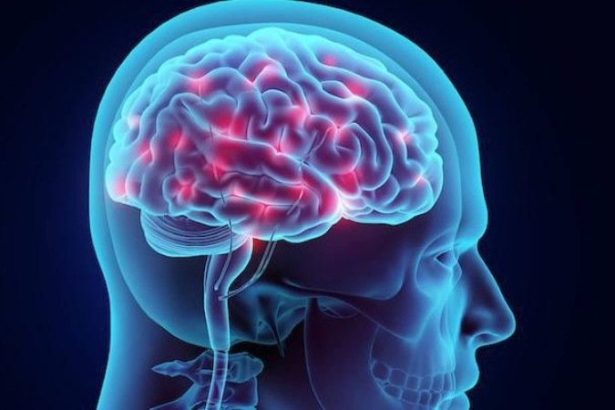 A epilepsia não é uma doença única, mas um conjunto de distúrbios convulsivos que afeta aproximadamente 50 milhões de pessoas em todo o mundo - (crédito: The Neurology Center for Epilepsy and Seizures/Divulgação ) A epilepsia não é uma doença única, mas um conjunto de distúrbios convulsivos que afeta aproximadamente 50 milhões de pessoas em todo o mundo - (crédito: The Neurology Center for Epilepsy and Seizures/Divulgação )