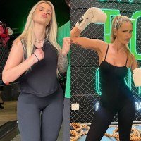 No final de 2024, a influenciadora Yasmin Brunet enfrentou o lipedema e compartilhou sua evolu&ccedil;&atilde;o nas redes sociais 