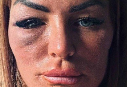 Sean McInnes era lutador de MMA e havia competido no evento Lion Fight 68, uma importante competição de muay thai -  (crédito: BBC) -Sean McInnes era lutador de MMA e havia competido no evento Lion Fight 68, uma importante competição de muay thai -  (crédito: BBC)