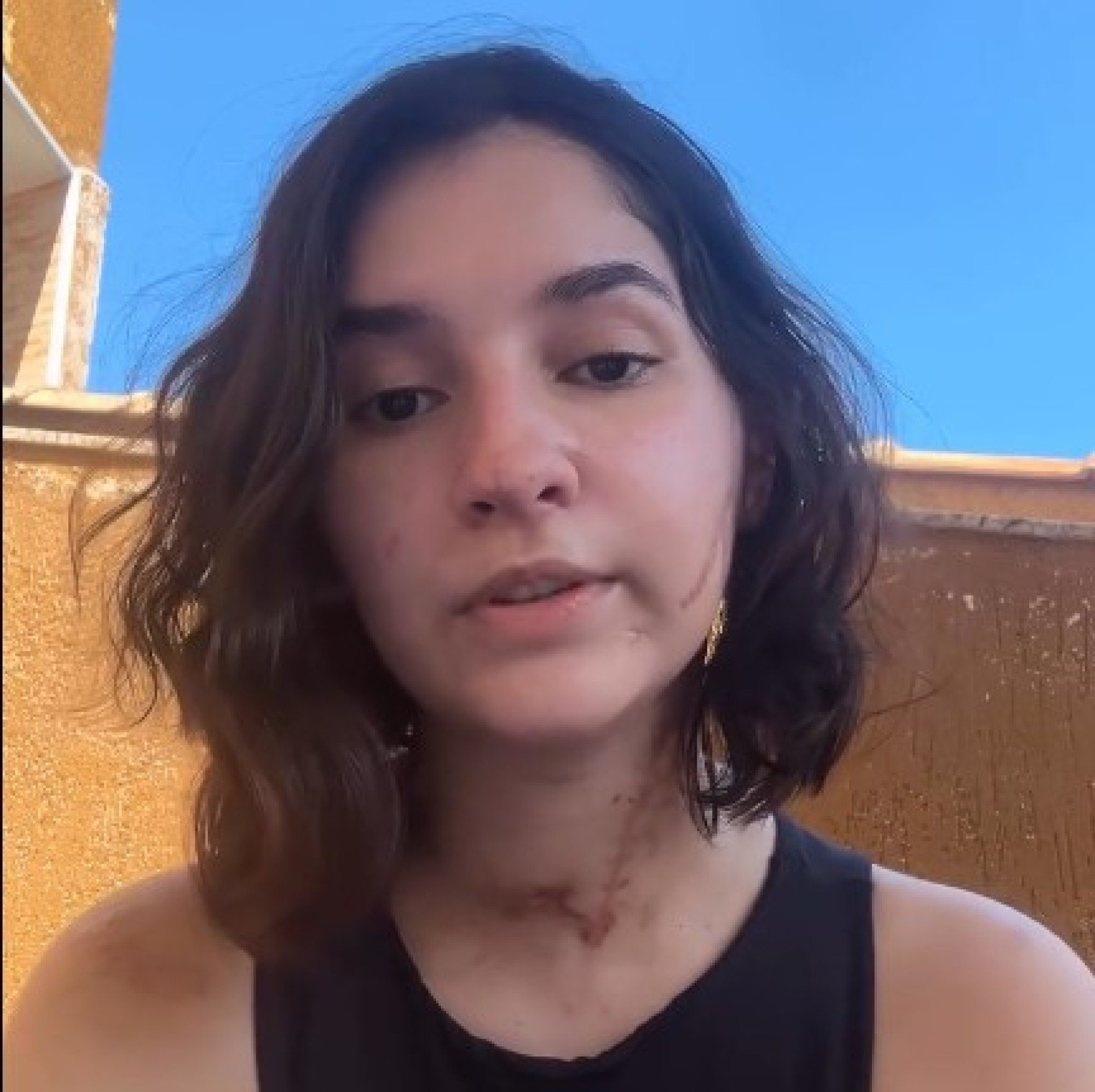 Vítima de tentativa de feminicídio fala pela 1ª vez sobre episódio