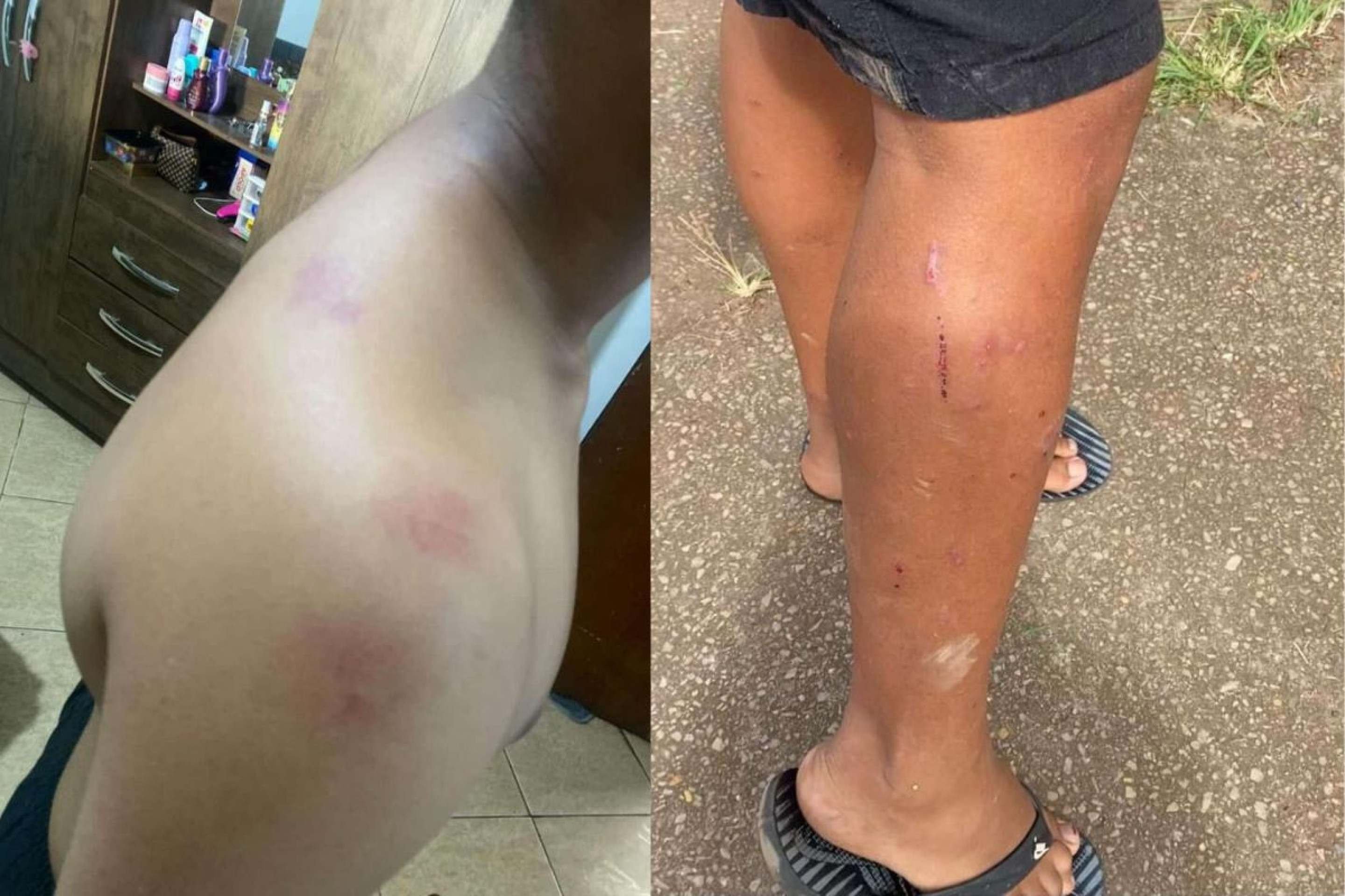 Família acusa a PM de ter agredido adolescente durante revista