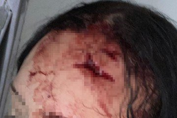 Homem ataca mulher no Varjão e tenta matá-la após ela receber alta