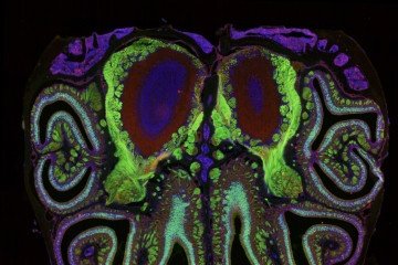 Fotografia microscópica de uma secção transversal do nariz de um rato -  (crédito: Datta Lab)
