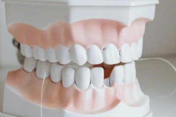 Sonhar com dentes quebrados é uma experiência comum que desperta angústia e muitos questionamentos -  (crédito: Pexels/Divulgação )