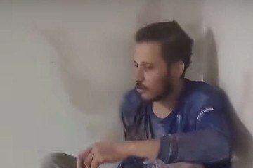 O homem responderá por lesão corporal de natureza gravíssima -  (crédito: Reprodução/Redes sociais)
