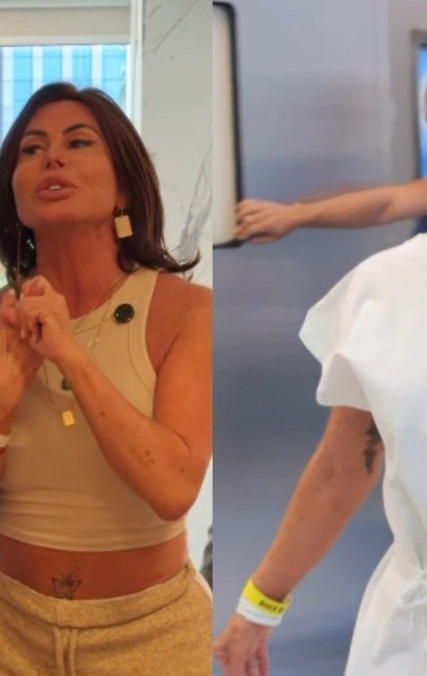 O que é a capuzplastia, cirurgia íntima feita por Gretchen -  (crédito: Instagram)