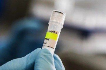 A hantavirose é uma doença transmitida por meio de urina, saliva, fezes ou pela própria mordida de roedores silvestres contaminados  -  (crédito: AFP  )