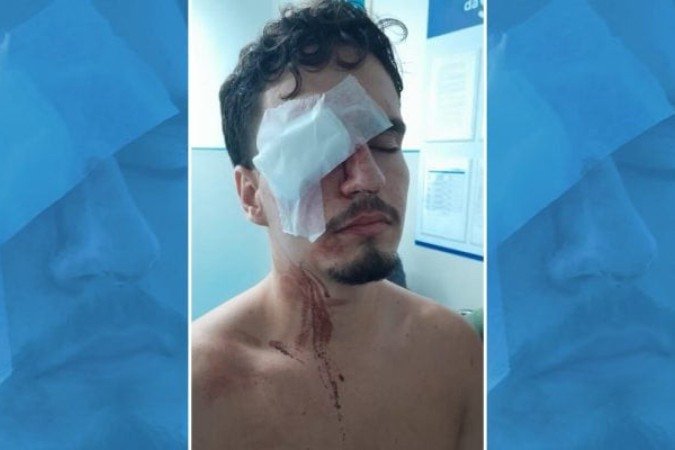 Torcedor do Vasco, Arthur Cortines perdeu a visão em confusão no clássico contra o Flamengo -  (crédito: Foto: Reprodução)