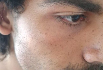Estudante da UnB foi v&iacute;tima de agress&atilde;o em uma unidade do Big Box na 408 Norte, no &uacute;ltimo s&aacute;bado (9/5) -  (crédito: Arquivo pessoal)