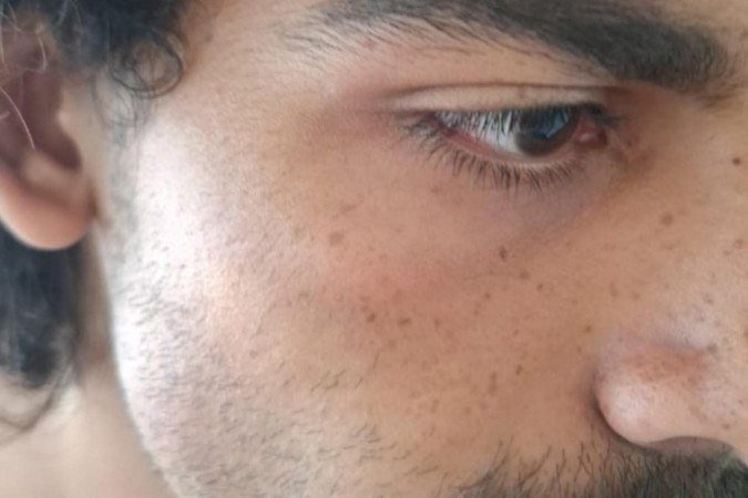 Estudante da UnB foi v&iacute;tima de agress&atilde;o em uma unidade do Big Box na 408 Norte, no &uacute;ltimo s&aacute;bado (9/5) -  (crédito: Arquivo pessoal)
