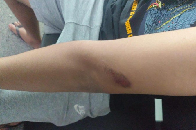 Vítima foi agredida e teve o celular levado pelos agressores - (crédito: PMDF) Vítima foi agredida e teve o celular levado pelos agressores - (crédito: PMDF)