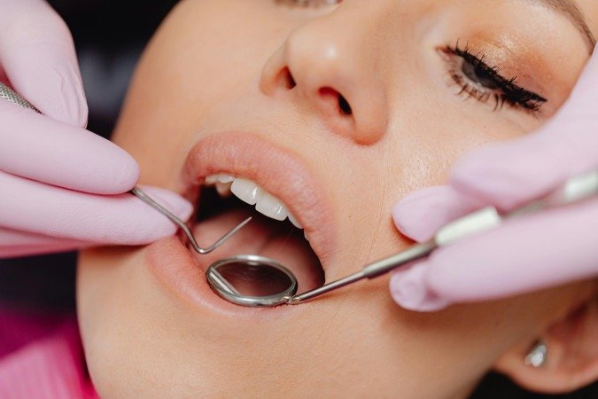Dados apontam que em mulheres a vulnerabilidade por doenças gengivais é maior em momentos de grande variação hormonal, como adolescência, gestação e menopausa - (crédito: Reprodução) Dados apontam que em mulheres a vulnerabilidade por doenças gengivais é maior em momentos de grande variação hormonal, como adolescência, gestação e menopausa - (crédito: Reprodução)