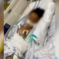 A criança deu entrada no Hmib com dificuldade de respirar -  (crédito: Material cedido ao Correio)