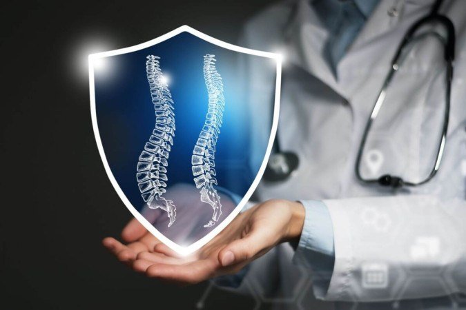 Escoliose pode evoluir de forma silenciosa e exige atenção aos sinais durante o crescimento (Imagem: mi_viri | Shutterstock) - (crédito: EdiCase) Escoliose pode evoluir de forma silenciosa e exige atenção aos sinais durante o crescimento (Imagem: mi_viri | Shutterstock) - (crédito: EdiCase)