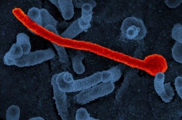 Eletromicrografia do vírus Ebola -  (crédito: NIAID / Wikimedia Commons)