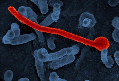 As autoridades de saúde reforçam que o Ebola não é transmitido pelo ar. A transmissão ocorre apenas por contato direto com secreções e fluidos corporais de pessoas infectadas, após o início dos sintomas -  (crédito: NIAID / Wikimedia Commons) -As autoridades de saúde reforçam que o Ebola não é transmitido pelo ar. A transmissão ocorre apenas por contato direto com secreções e fluidos corporais de pessoas infectadas, após o início dos sintomas -  (crédito: NIAID / Wikimedia Commons)