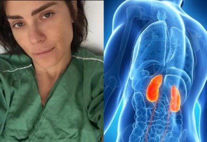 Conheça os sintomas da infecção grave que acometeu Carolina Dieckmmann -  (crédito: Reprodução/Instagram) -Conheça os sintomas da infecção grave que acometeu Carolina Dieckmmann -  (crédito: Reprodução/Instagram)