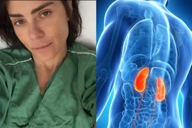 Conheça os sintomas da infecção grave que acometeu Carolina Dieckmmann - (crédito: Reprodução/Instagram) Conheça os sintomas da infecção grave que acometeu Carolina Dieckmmann - (crédito: Reprodução/Instagram)