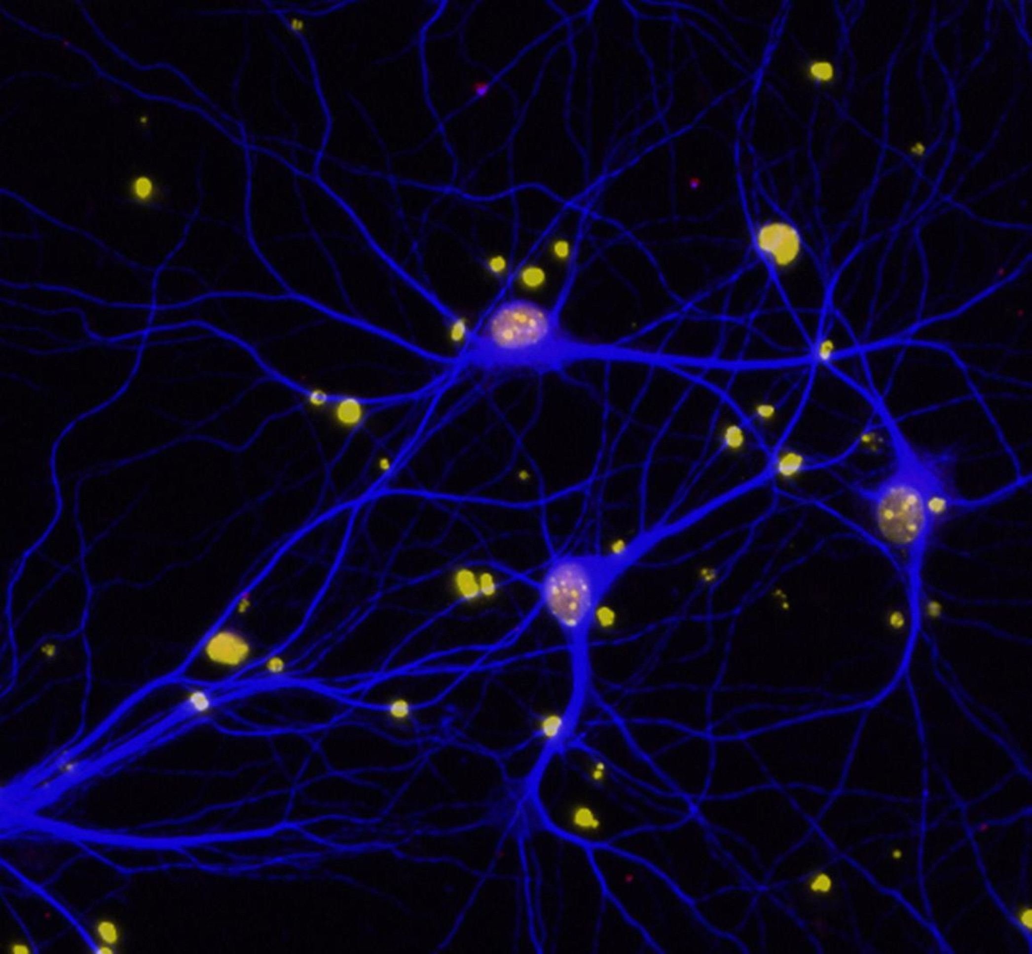 Novo composto contra Alzheimer reduz danos no cérebro em estudo