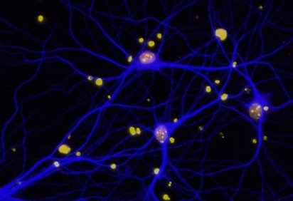 A reparação do DNA em células cerebrais lesionadas (em amarelo) freou o avanço da doença em camundongos, com redução dos sintomas cognitivos associados ao Alzheimer -  (crédito: Lennart Mucke/Divulgação )