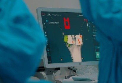 Interface digital exibe planejamento em tempo real de cirurgia rob&oacute;tica de joelho, auxiliando na precis&atilde;o do implante nacional -  (crédito: Divulga&ccedil;&atilde;o/Leonardo Figueiredo) -Interface digital exibe planejamento em tempo real de cirurgia rob&oacute;tica de joelho, auxiliando na precis&atilde;o do implante nacional -  (crédito: Divulga&ccedil;&atilde;o/Leonardo Figueiredo)