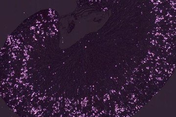 O acúmulo de oxalato pode desencadear inflamações e danos nos rins e no sistema cardiovascular, como mostra a pesquisa - (crédito: Martin Reichel / Charité – Universitätsmedizin Berlin) O acúmulo de oxalato pode desencadear inflamações e danos nos rins e no sistema cardiovascular, como mostra a pesquisa - (crédito: Martin Reichel / Charité – Universitätsmedizin Berlin)