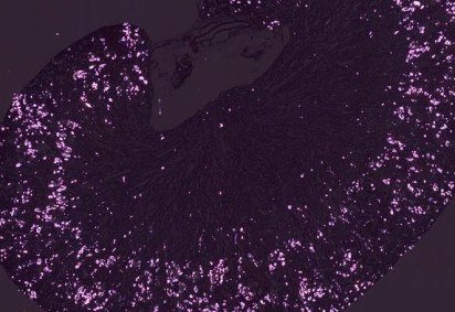 O ac&uacute;mulo de oxalato pode desencadear inflama&ccedil;&otilde;es e danos nos rins e no sistema cardiovascular, como mostra a pesquisa -  (crédito: Martin Reichel / Charit&eacute; &ndash; Universit&auml;tsmedizin Berlin) -O ac&uacute;mulo de oxalato pode desencadear inflama&ccedil;&otilde;es e danos nos rins e no sistema cardiovascular, como mostra a pesquisa -  (crédito: Martin Reichel / Charit&eacute; &ndash; Universit&auml;tsmedizin Berlin)