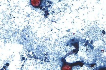Bactéria que causa diarreia explosiva pode ter contaminado verduras nos EUA - (crédito: Reprodução/CDC) Bactéria que causa diarreia explosiva pode ter contaminado verduras nos EUA - (crédito: Reprodução/CDC)