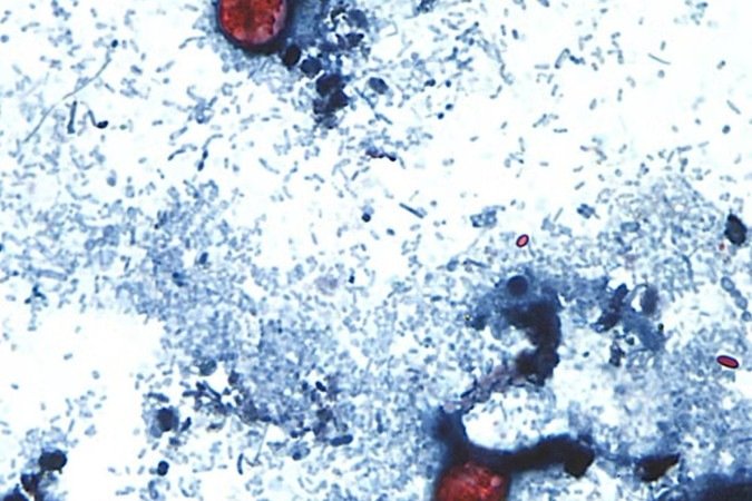 Bactéria que causa diarreia explosiva pode ter contaminado verduras nos EUA - (crédito: Reprodução/CDC) Bactéria que causa diarreia explosiva pode ter contaminado verduras nos EUA - (crédito: Reprodução/CDC)