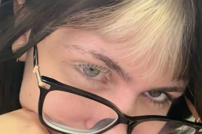 O contato acidental dos produtos com a superfície ocular pode provocar lesões graves na córnea - (crédito: Reprodução/TikTok @cnoletto) O contato acidental dos produtos com a superfície ocular pode provocar lesões graves na córnea - (crédito: Reprodução/TikTok @cnoletto)