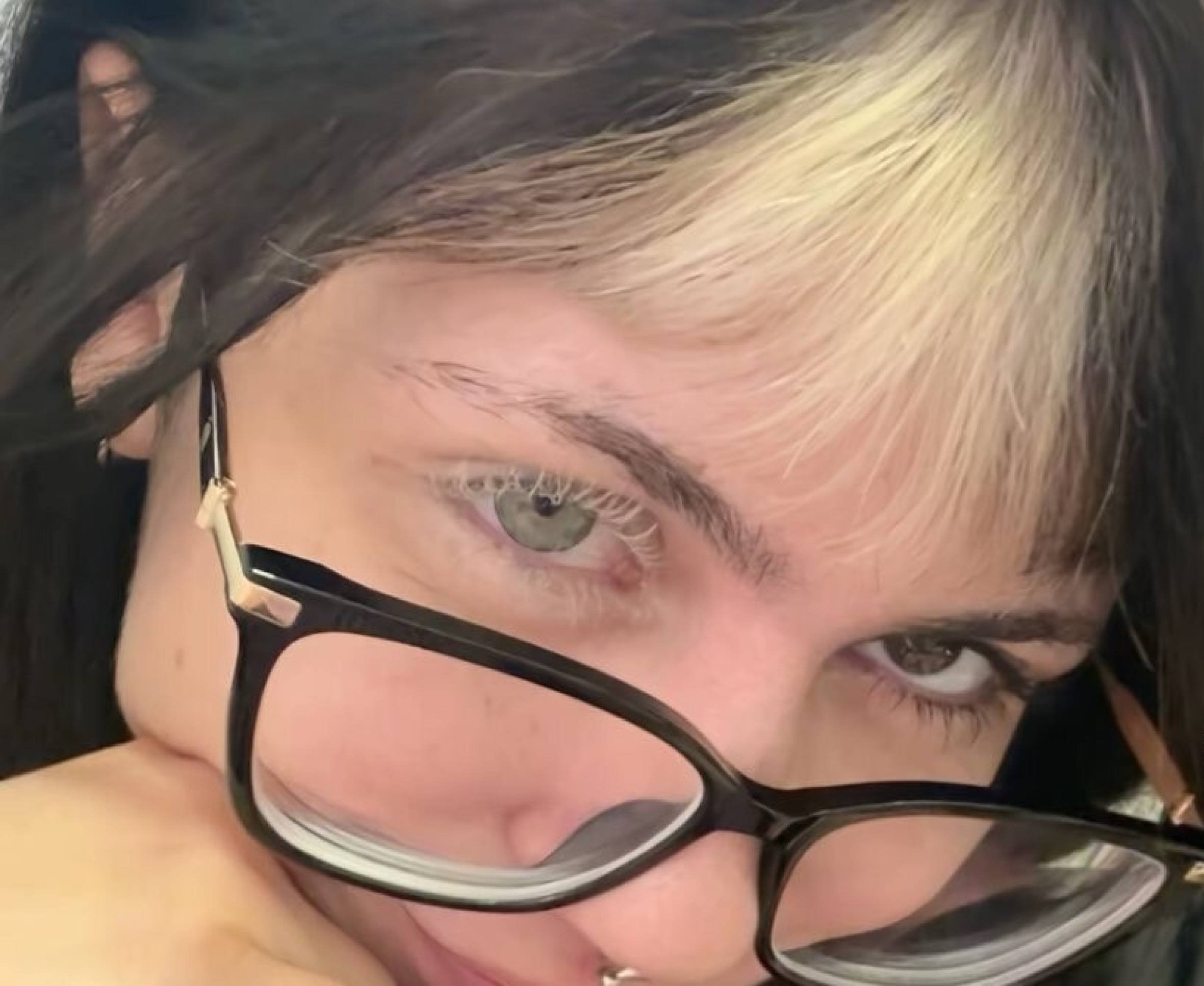 Bleached lashes: trend de descolorir cílios traz riscos graves à visão