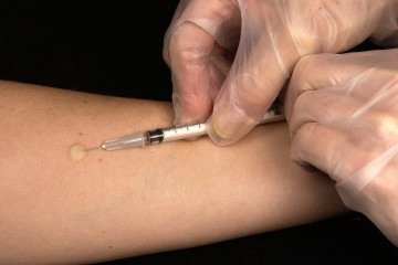 Caso os resultados sejam confirmados em estudos mais abrangentes, uma vacina poderá prevenir um tipo de câncer pancreático altamente letal - (crédito: PixaBay/Divulgação ) Caso os resultados sejam confirmados em estudos mais abrangentes, uma vacina poderá prevenir um tipo de câncer pancreático altamente letal - (crédito: PixaBay/Divulgação )