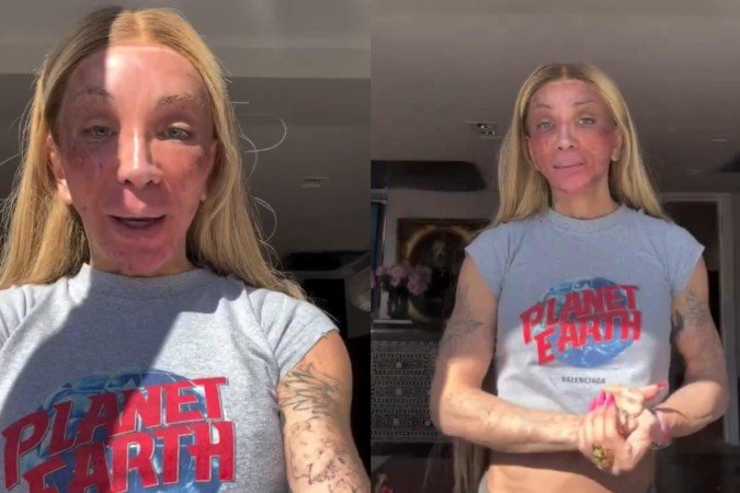 Maya Massafera remove camada da pele facial e impressiona seguidores - (crédito: Reprodução/Instagram) Maya Massafera remove camada da pele facial e impressiona seguidores - (crédito: Reprodução/Instagram)