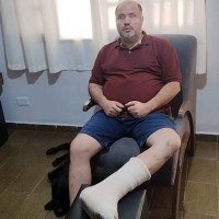 Victor Uchoa é deficiente visual e teve uma fratura no tornozelo esquerdo após ser atropelado -  (crédito: Material cedido ao Correio)