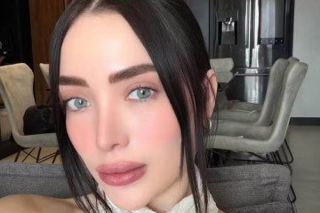 Influenciadora morre aos 30 anos e causa choca amantes de cirurgias plásticas - (crédito: Reprodução/Instagram) Influenciadora morre aos 30 anos e causa choca amantes de cirurgias plásticas - (crédito: Reprodução/Instagram)