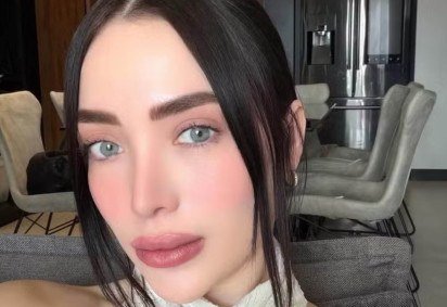 Influenciadora morre aos 30 anos e causa choca amantes de cirurgias plásticas -  (crédito: Reprodução/Instagram) -Influenciadora morre aos 30 anos e causa choca amantes de cirurgias plásticas -  (crédito: Reprodução/Instagram)