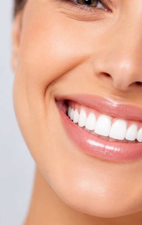 Celebridades ajudam a impulsionar busca por sorrisos mais naturais -  (crédito: Divulgação)
