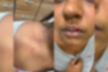 O agressor desferiu socos, puxões de cabelo e aplicou uma esganadura contra a vítima -  (crédito: Material cedido ao Correio)