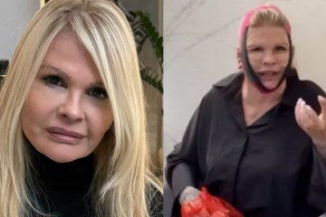 Monique Evans surge com rosto enfaixado e surpreende fãs; saiba o motivo -  (crédito: Reprodução/Instagram)