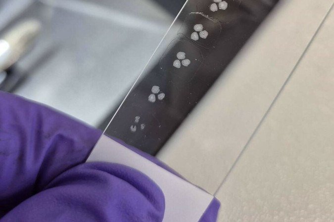 Pesquisa cultiva organoides cerebrais com desenvolvimento semelhante ao
cérebro humano - (crédito: DCN van der Heijden / UMC Utrecht) Pesquisa cultiva organoides cerebrais com desenvolvimento semelhante ao
cérebro humano - (crédito: DCN van der Heijden / UMC Utrecht)