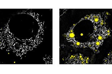 Células do fígado vistas sob microscopia de fluorescência: à esquerda, células sadias; à direita, em amarelo, destacam-se gotículas de gordura. Pesquisa revelou que ativar o receptor ERβ induz o órgão a oxidar completamente esses lipídios para gerar energia - (crédito: Débora Santos Rocha et al./Comprehensive Physiology) Células do fígado vistas sob microscopia de fluorescência: à esquerda, células sadias; à direita, em amarelo, destacam-se gotículas de gordura. Pesquisa revelou que ativar o receptor ERβ induz o órgão a oxidar completamente esses lipídios para gerar energia - (crédito: Débora Santos Rocha et al./Comprehensive Physiology)